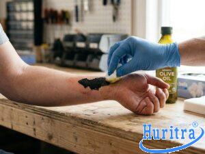 tẩy nhựa đường dính trên da