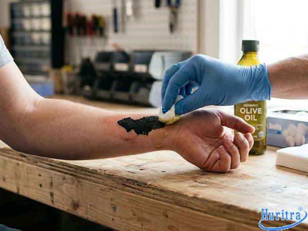 Cách tẩy nhựa đường dính trên da nhanh, an toàn tại nhà 8 tẩy nhựa đường dính trên da